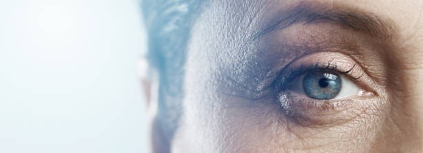 Ögonlaserkirurgi: Ett lyckat förfarande